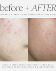 Clear Complexion Healing Masque