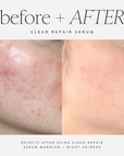 Clear Repair Serum